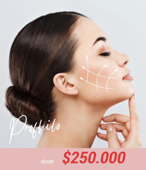 profhilo